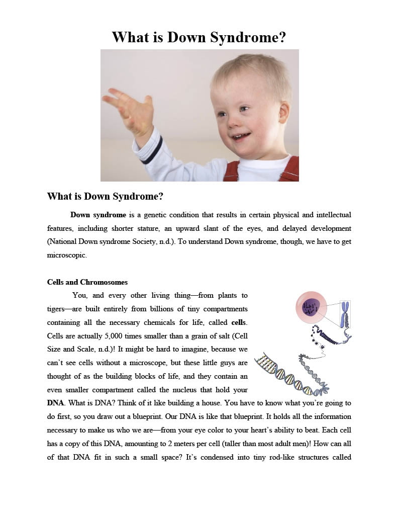 Down Syndrome Reading Comprehension Article By Teach Simple